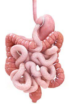 Gastric Bypass